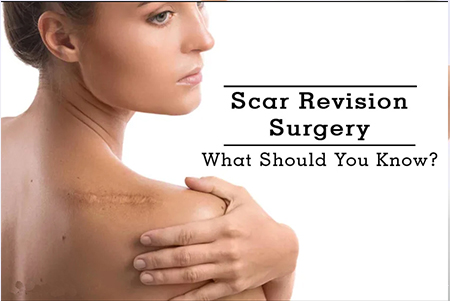 Scar Revision Surgery